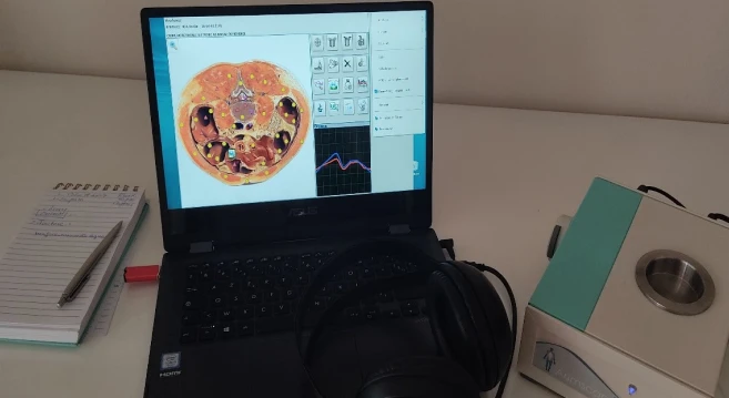 Claudia Stroia Bilan Bioresonance Nice Bilan Bioresonance